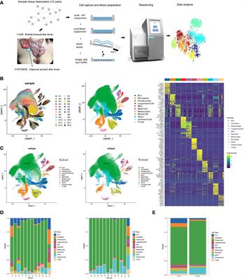 Single-cell RNA sequencing reveals distinct immunology profiles in human keloid